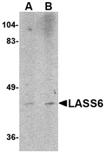 LASS6 Antibody