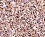 KLRA1 Antibody