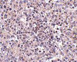 ZIP10 Antibody