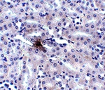 ZIP11 Antibody