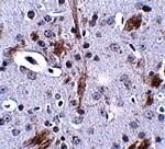 TTBK1 Antibody