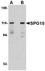 SPG15 Antibody