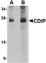 CDIP Antibody