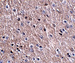 CDIP Antibody
