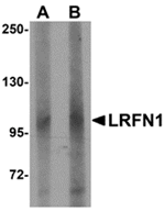 LRFN1 Antibody