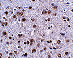 LRFN4 Antibody