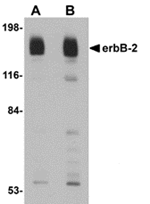 erbB-2 Antibody