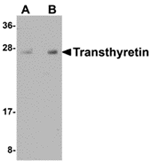 Transthyretin Antibody