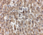 LDL-R Antibody