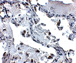 SH3BP4 Antibody