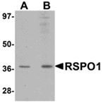 RSPO1 Antibody