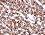 MACC1 Antibody