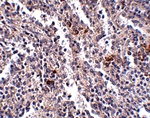 SYPL2 Antibody