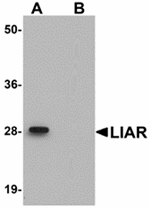 LIAR Antibody