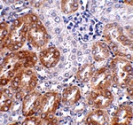 LIAR Antibody
