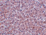 JMJD1B Antibody