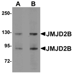 JMJD2B Antibody