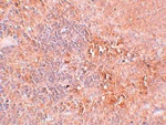 JMJD4 Antibody