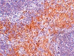 RIPK1 Antibody