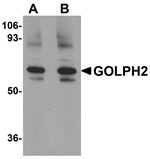 GOLPH2 Antibody