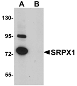 SRPX1 Antibody