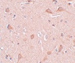 SIPA1L1 Antibody