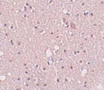 SIPA1L2 Antibody