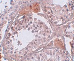 CLPH Antibody