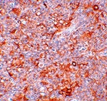 TMEM38B Antibody