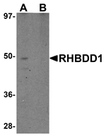 RHBDD1 Antibody