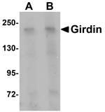 Girdin Antibody