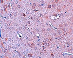 DCLK1 Antibody