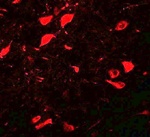 DCLK3 Antibody