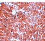 TMEM70 Antibody