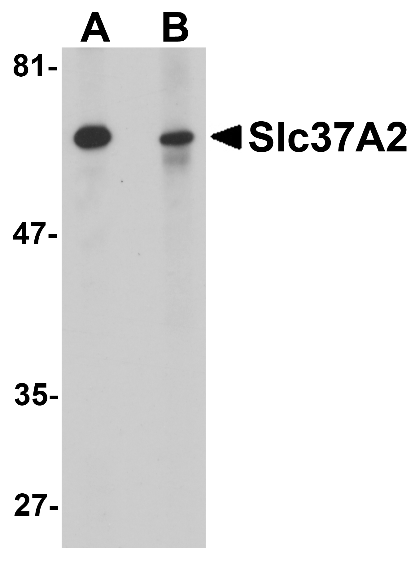 Slc37A2 Antibody
