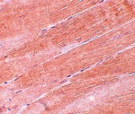 MYBPC2 Antibody
