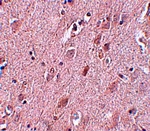 ZC3H12B Antibody