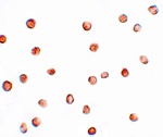 FAM82A1 Antibody