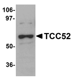 TCC52 Antibody