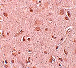 TINP1 Antibody