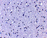 APC1 Antibody
