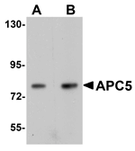APC5 Antibody