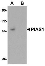 PIAS1 Antibody