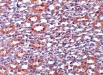 PIAS1 Antibody