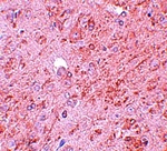 PIAS4 Antibody