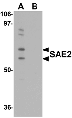 SAE2 Antibody