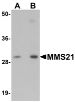 MMS21 Antibody