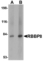 RBBP8 Antibody