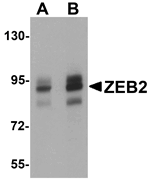 ZEB2 Antibody