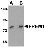 FREM1 Antibody